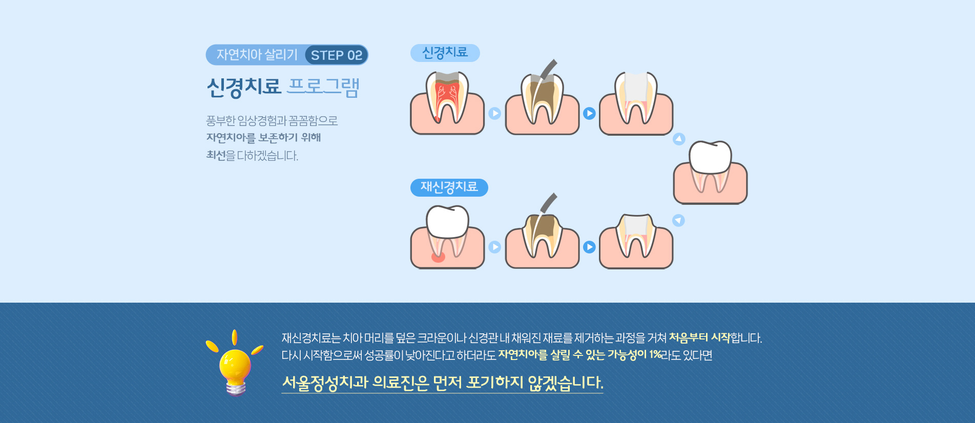 신경치료 프로그램